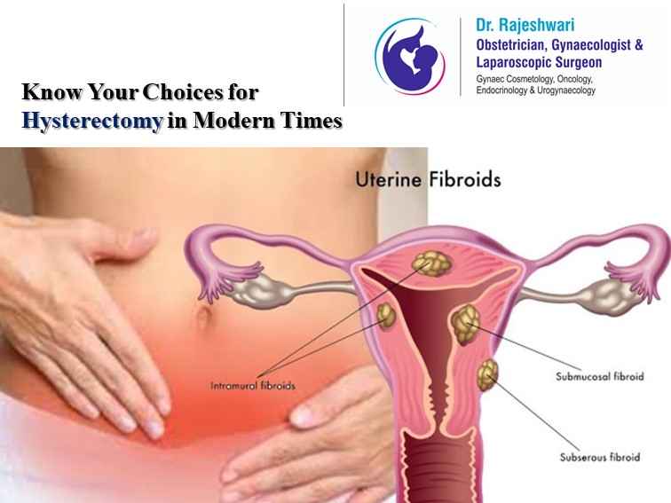 Know Your Choices for Hysterectomy in Modern Times