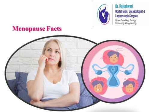 Menopause – What You Need to Know?