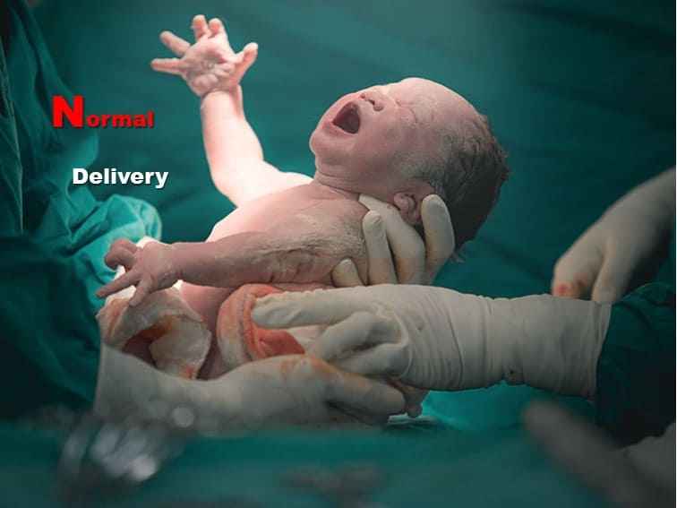 What is Normal Delivery / Childbirth?