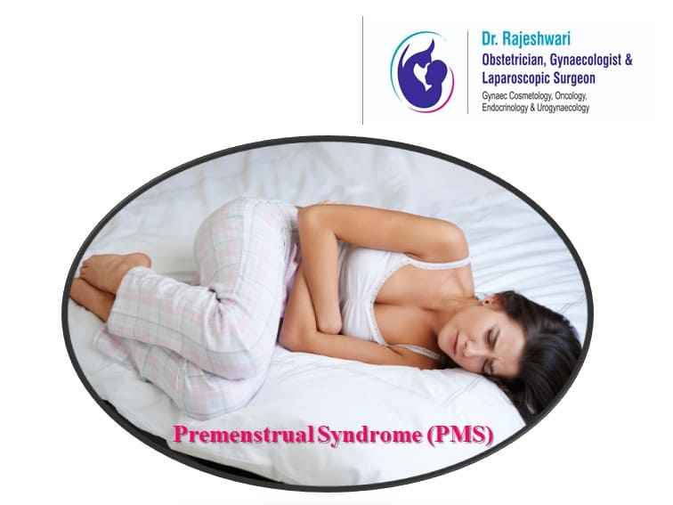 PMS – What Every Woman Must Know