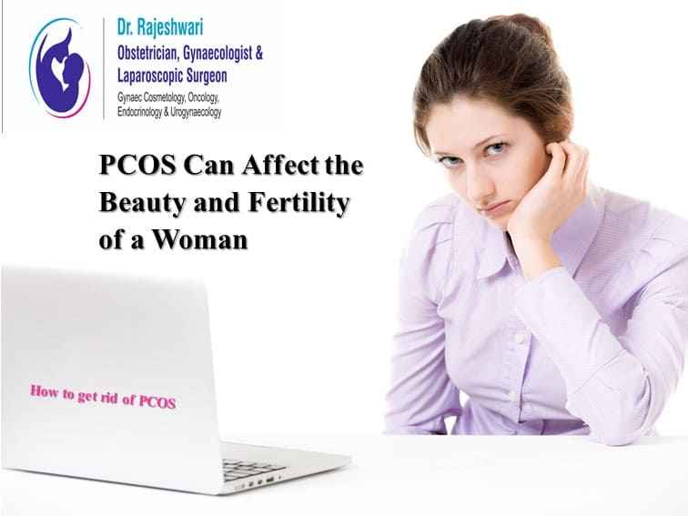 PCOS Can Affect Beauty and Fertility of a Woman
