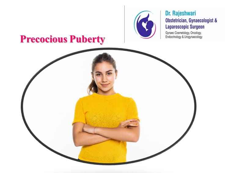 Precocious Puberty (Early Puberty in Girls)