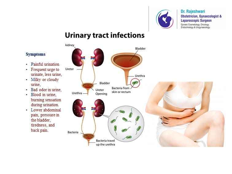 Take Urinary Tract Infections Seriously