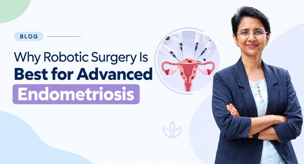 Why Robotic Surgery Is Best for Advanced Endometriosis